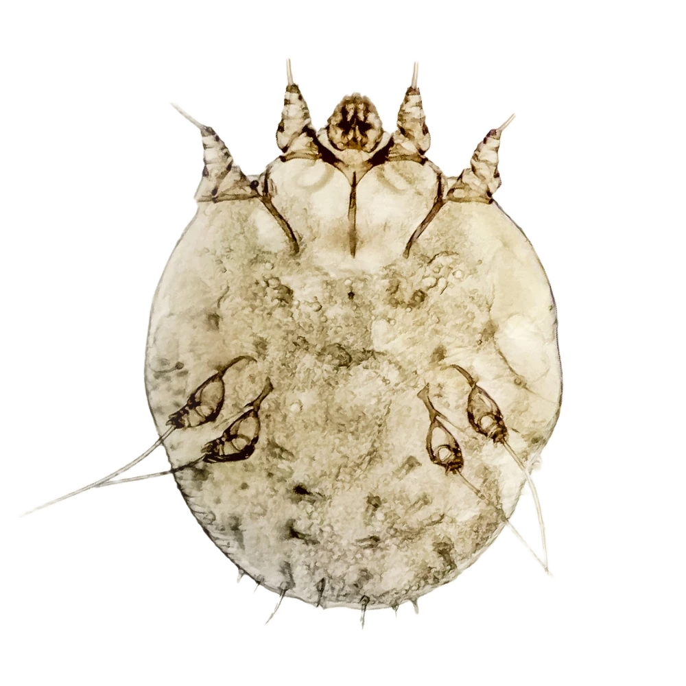 Krätzmilbe
