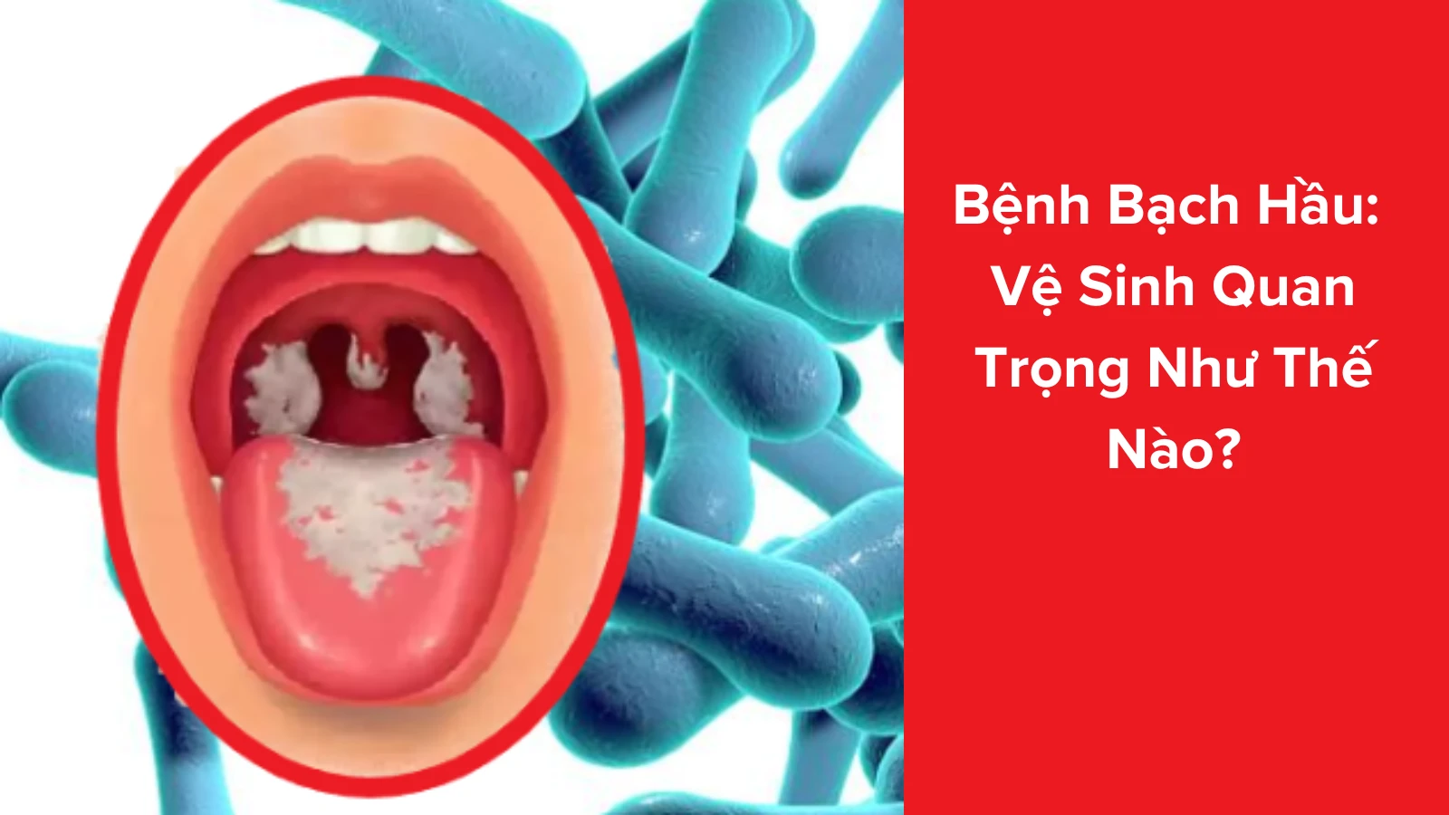 RIVN benh bach hau