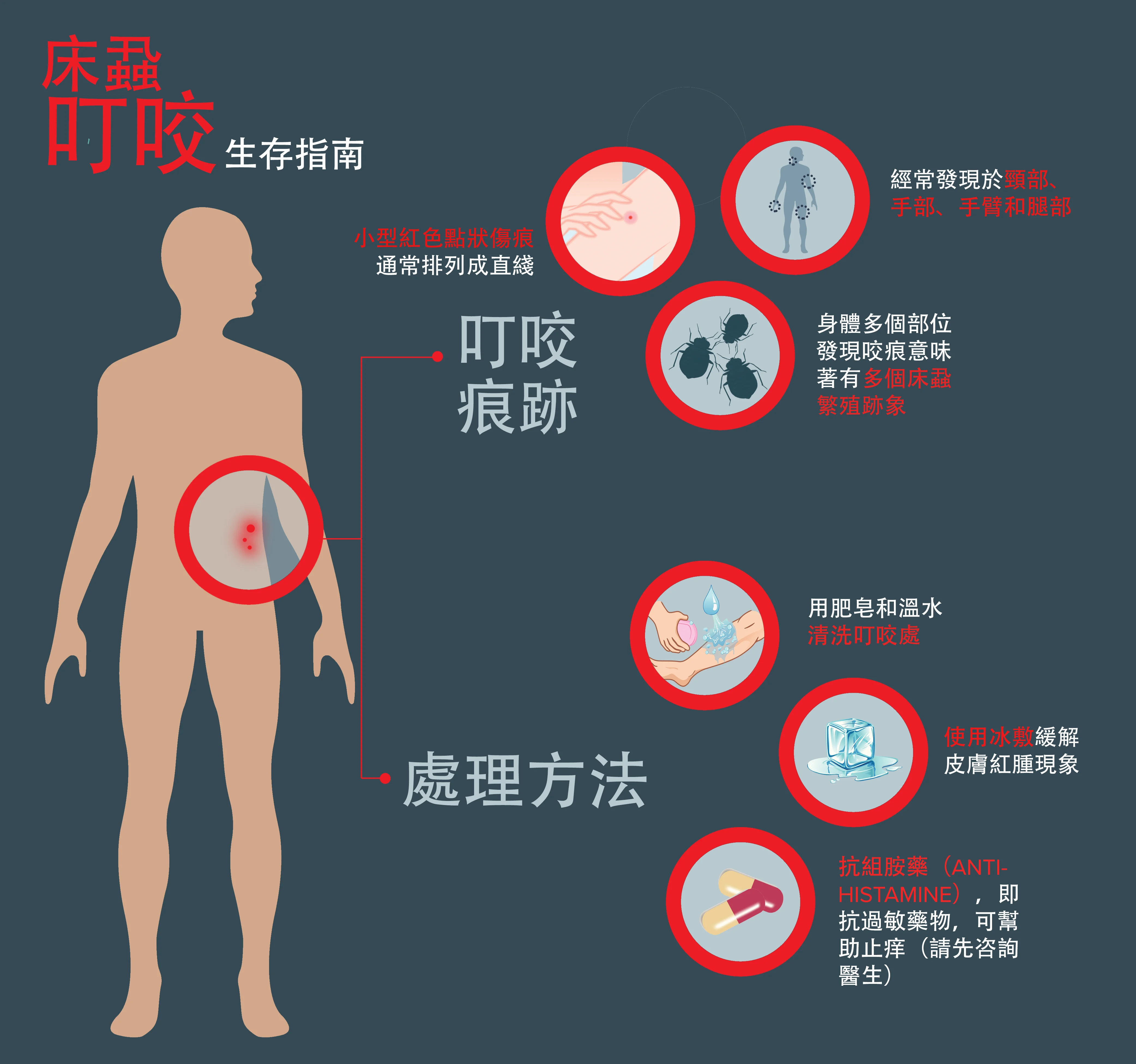 床蝨叮咬症狀及快速處理方法