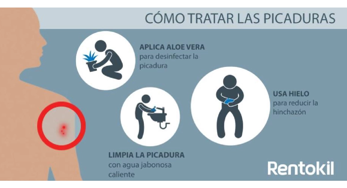 Como tratar las picaduras