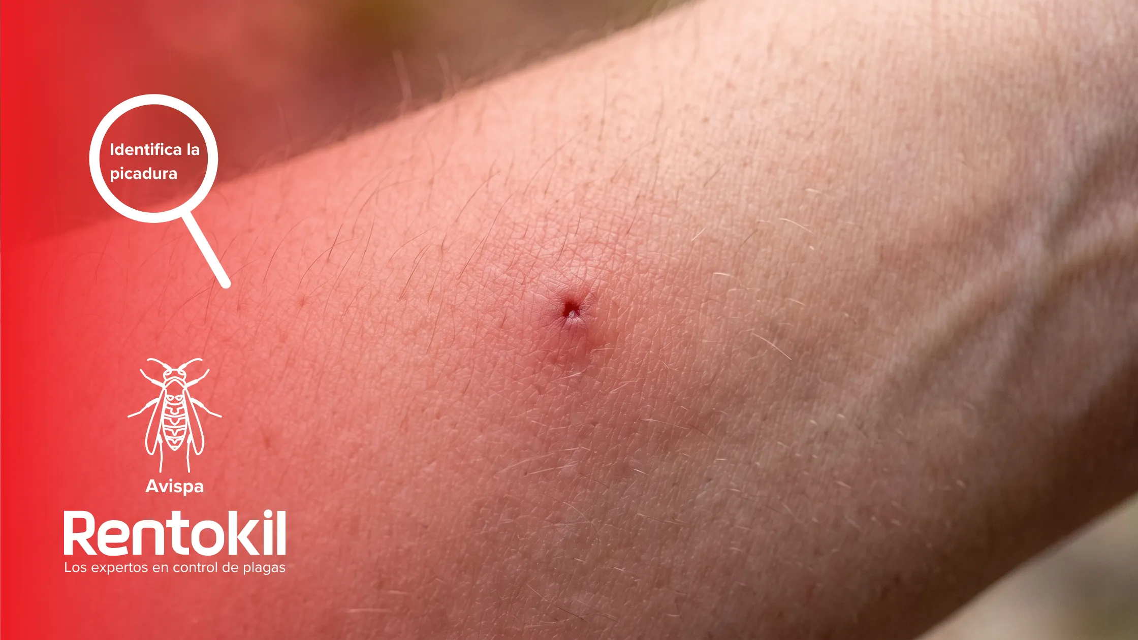 rentokil-es-identifica-la-picadura-avispa