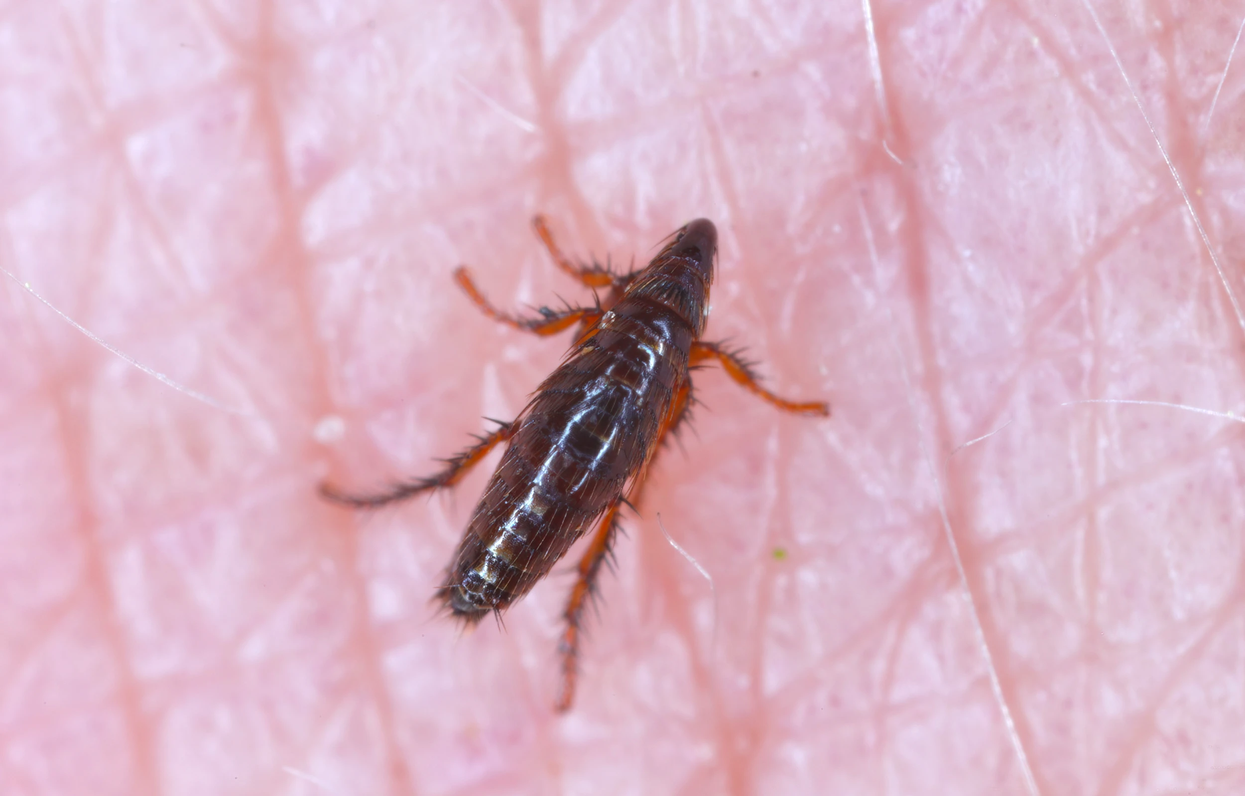 Menneskeloppe