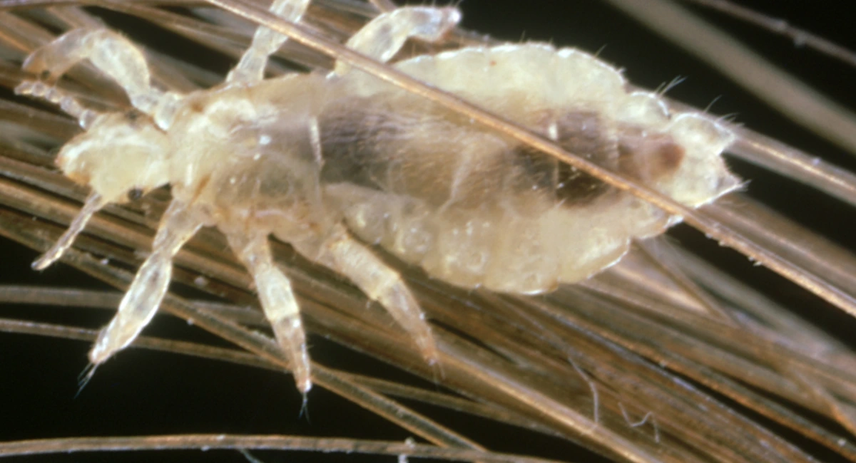 Head Lice