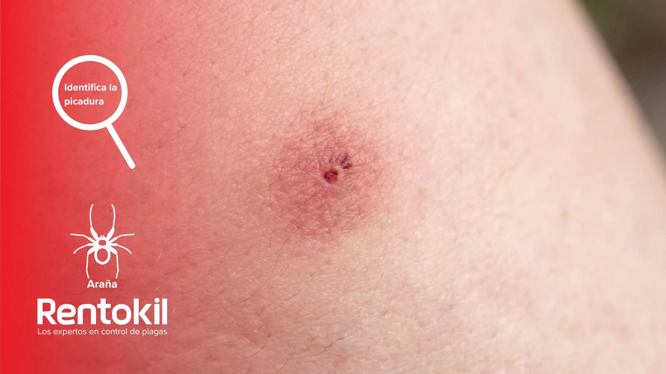 rentokil-es-identifica-la-picadura-arana