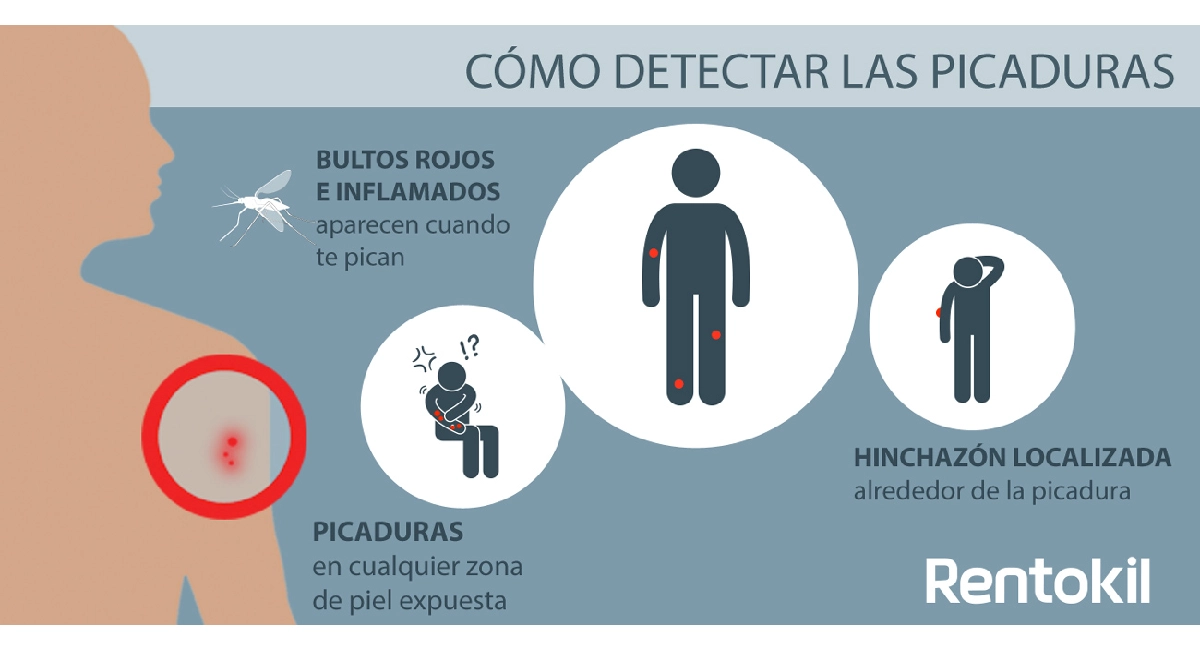 Mosquito-bites,-how-to-spot