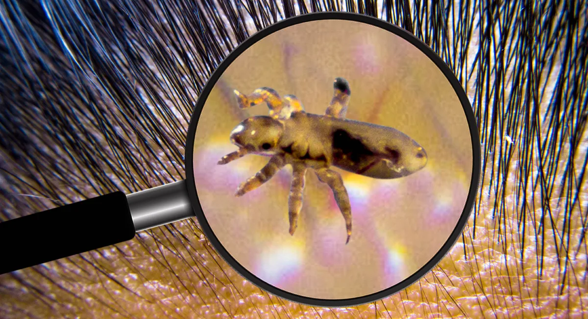 image of related disease-causing bugs eg triatomine bug/ kissing bug, lice
