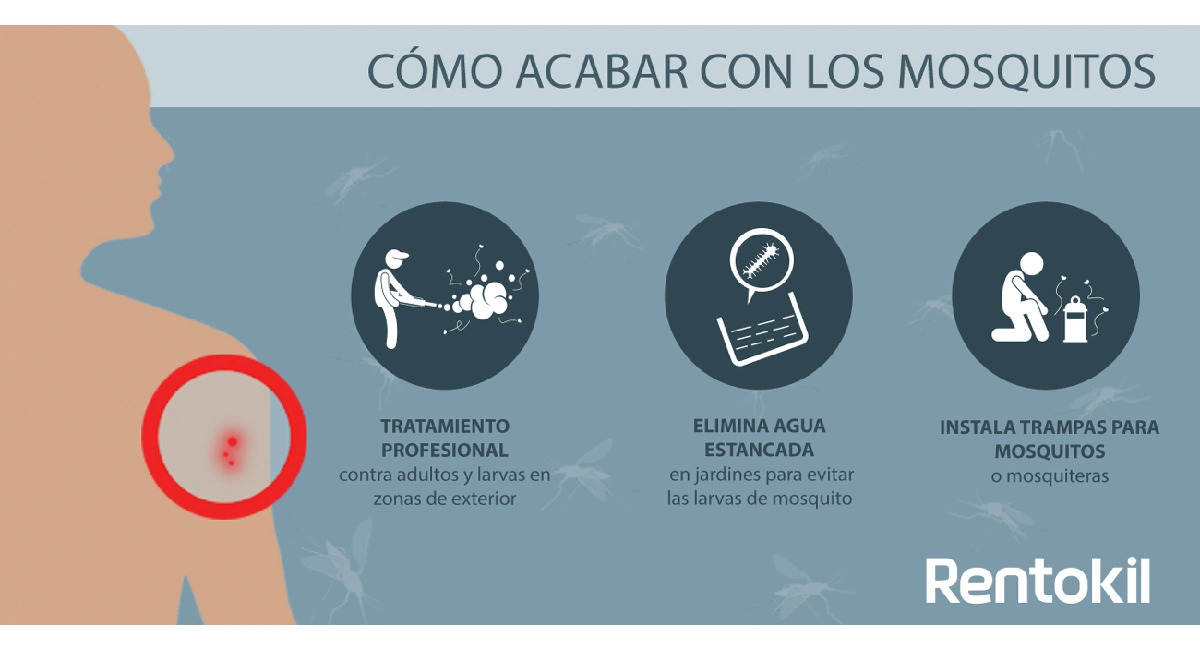 Mosquito-bites,-how-to-get-rid-of