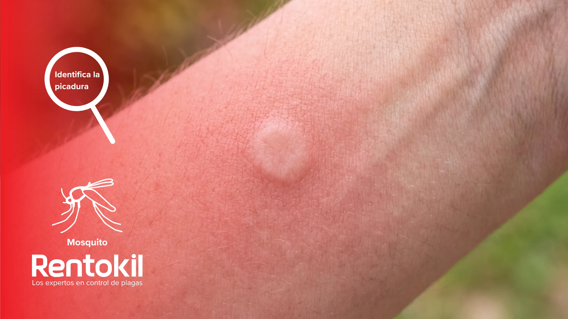 rentokil-es-identifica-la-picadura-mosquito