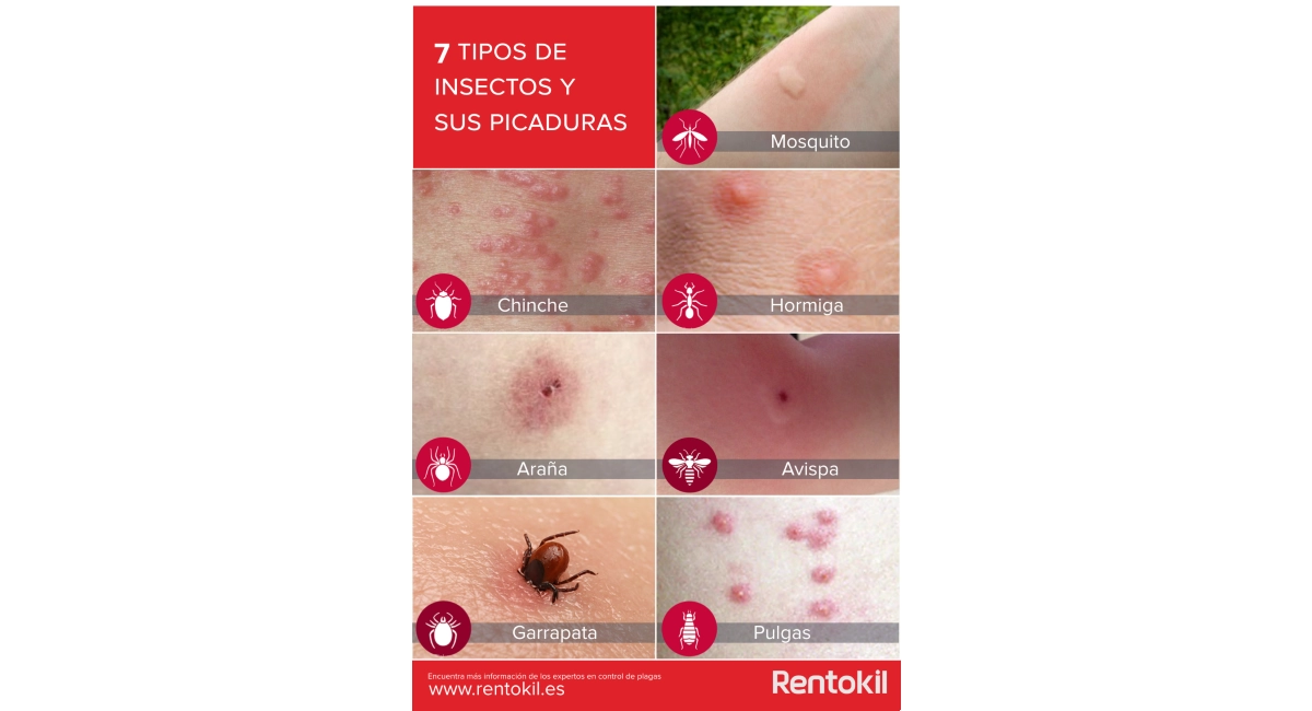 Picaduras