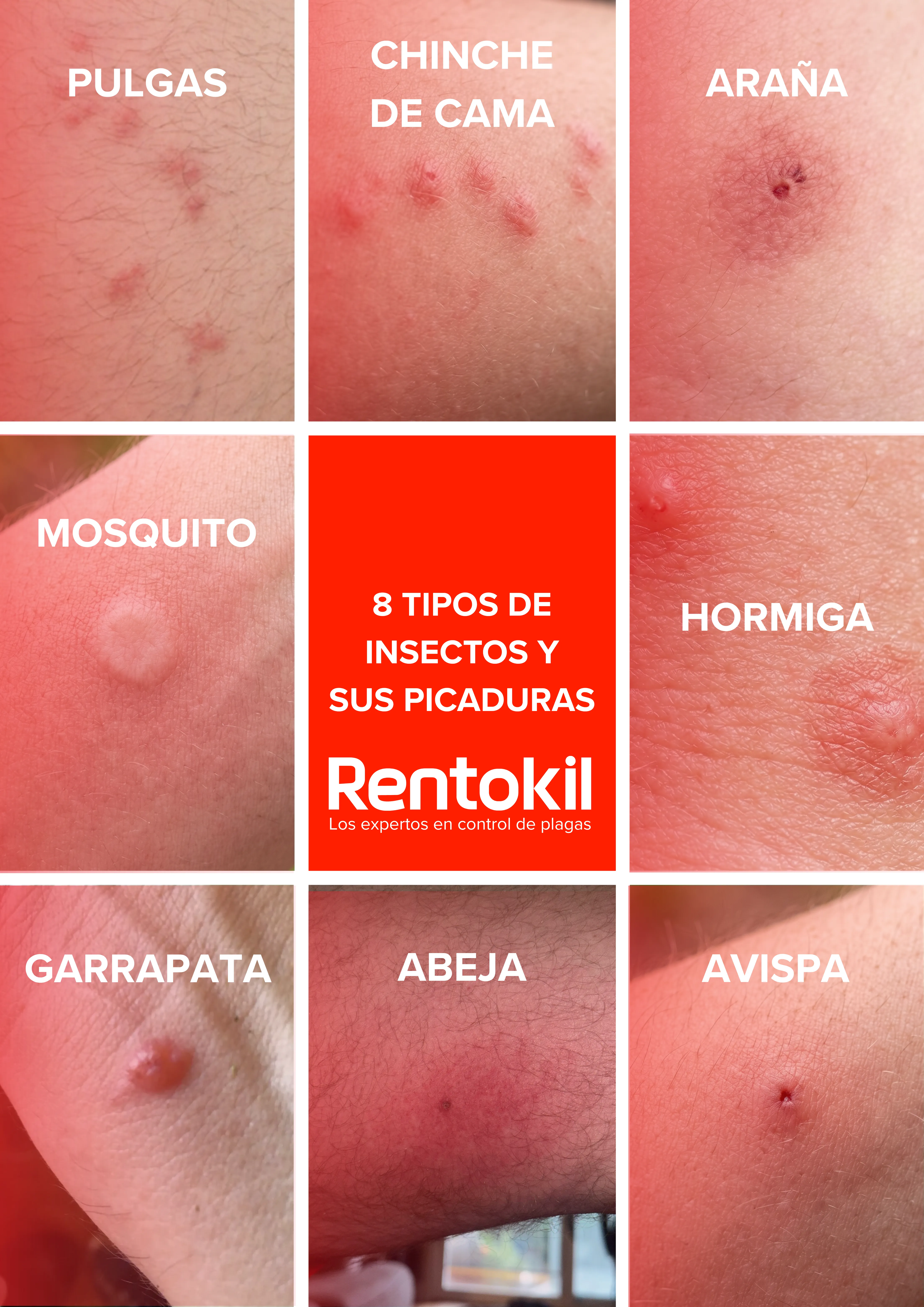 picaduras-de-insectos