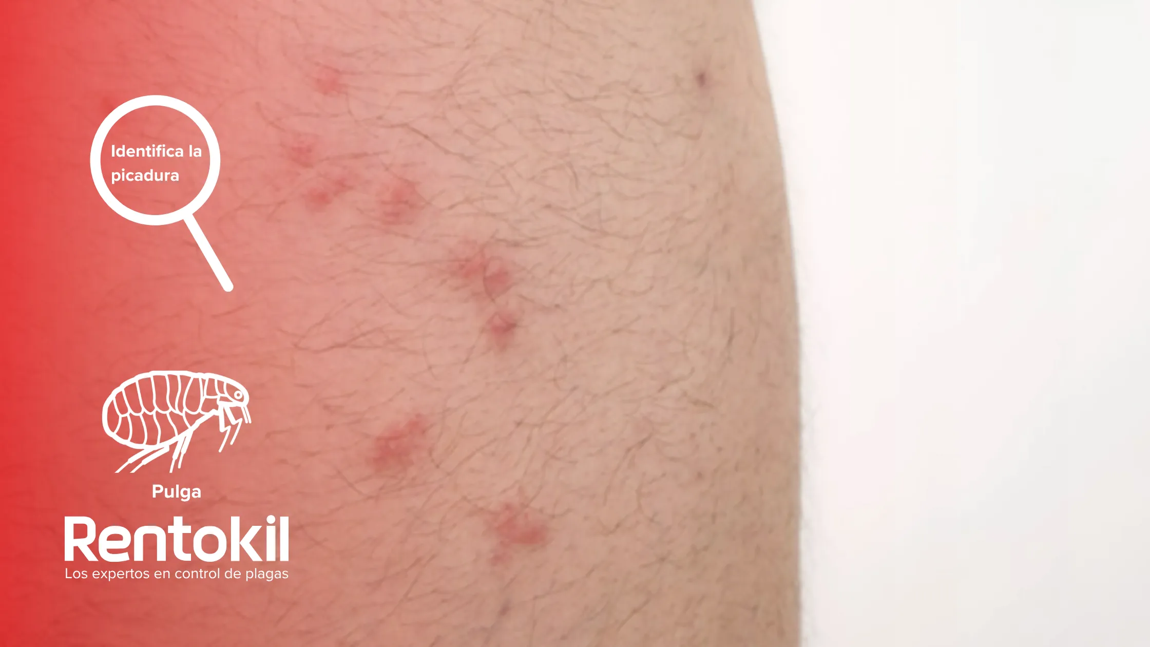 rentokil-es-identifica-la-picadura-pulga