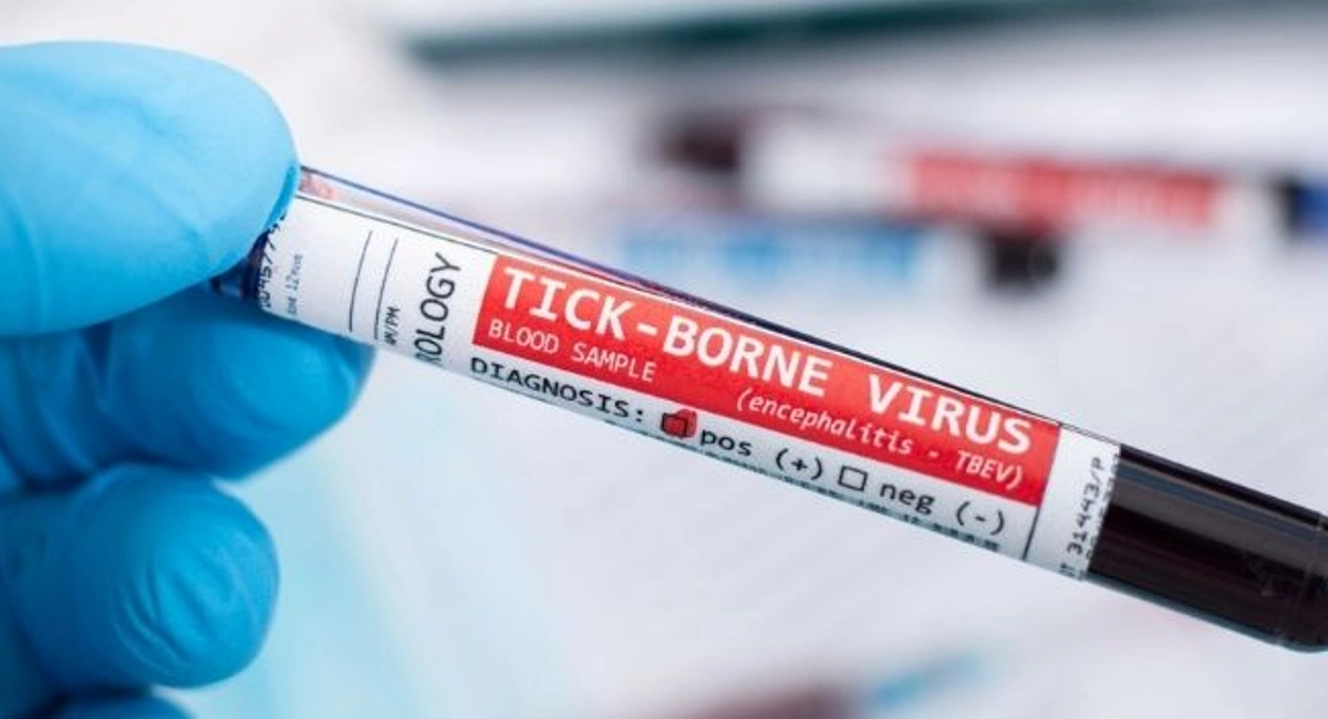 tick borne virus