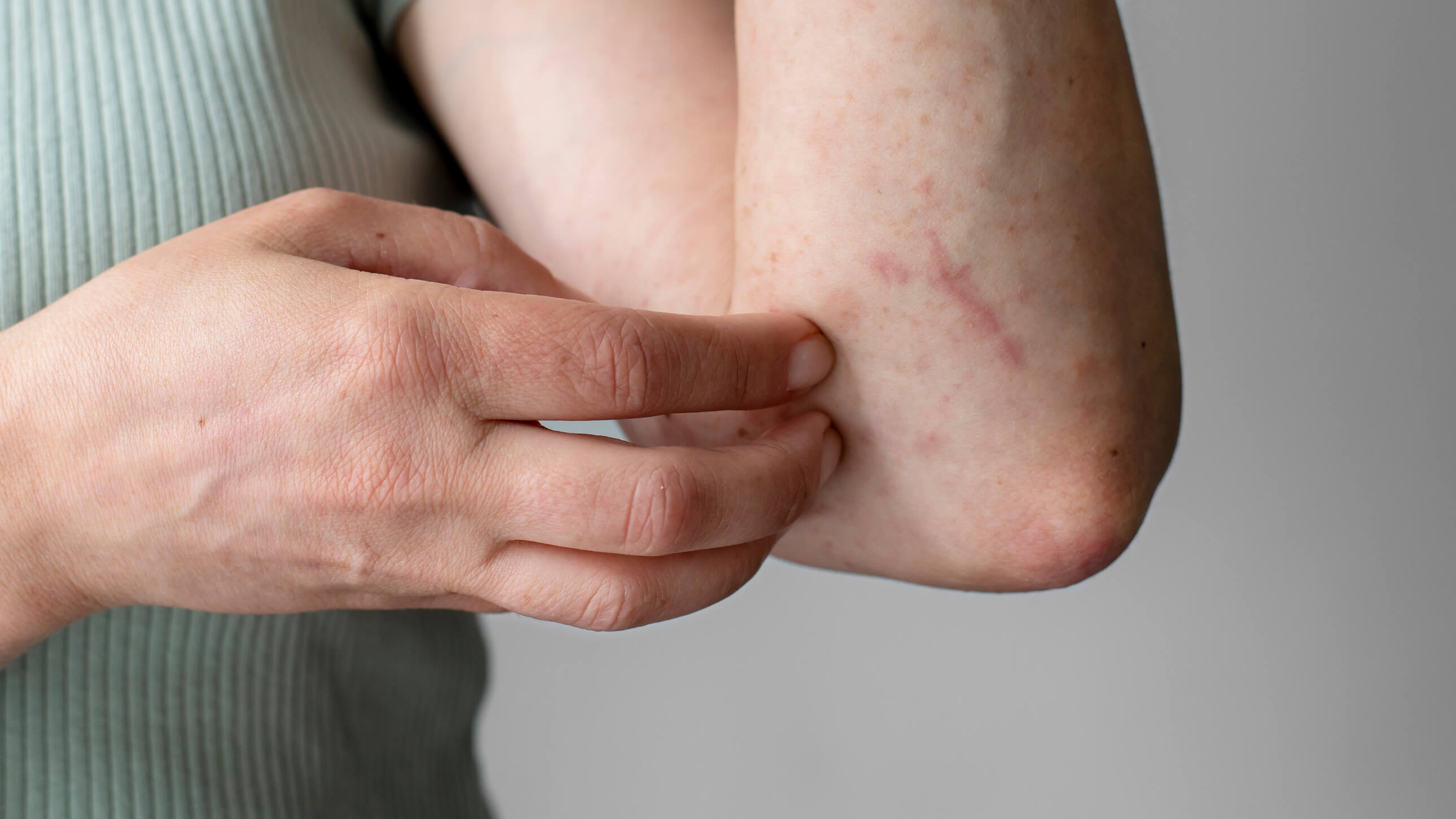 Bitten Body Part