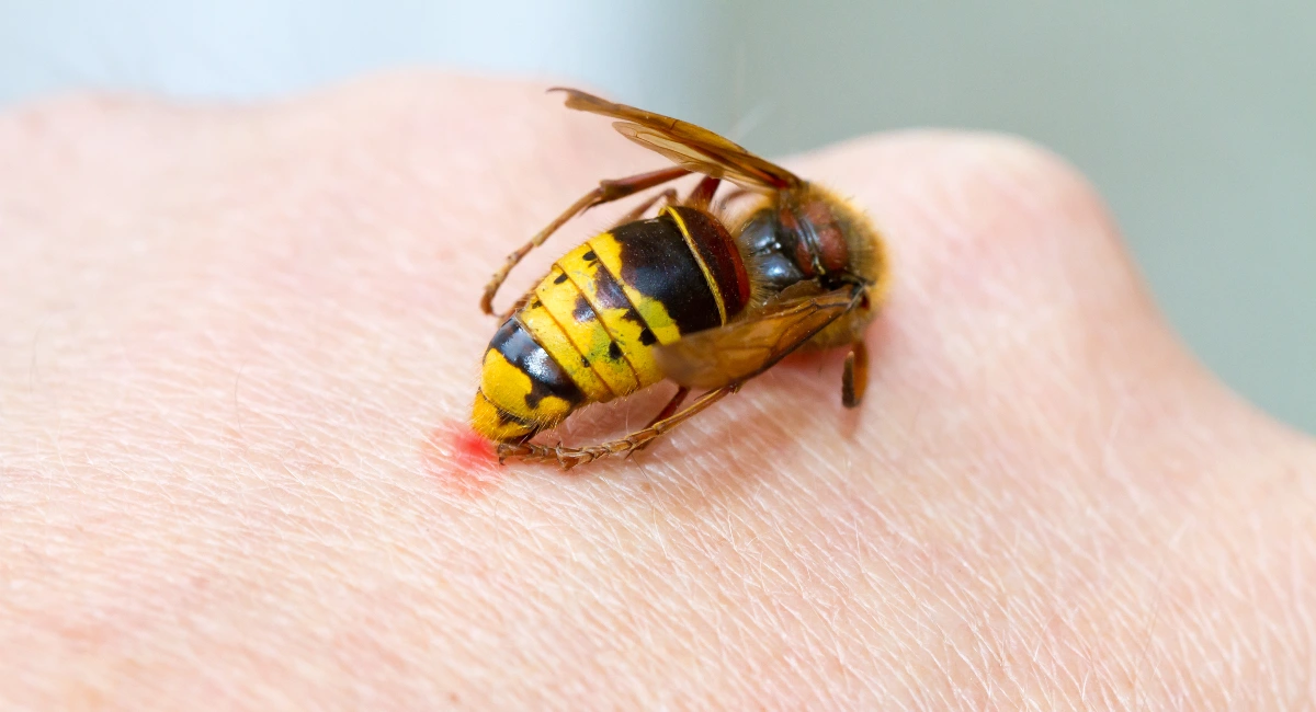 stinging