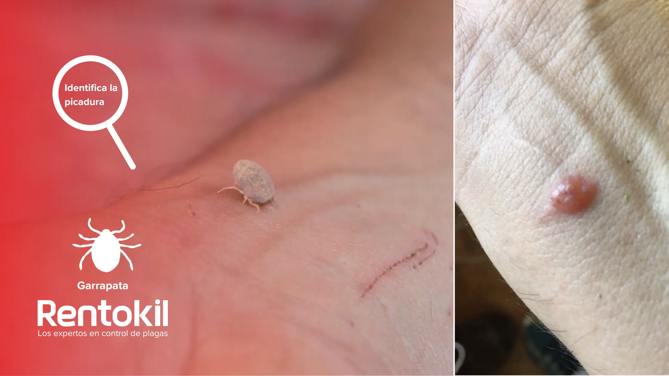 rentokil-es-identifica-la-picadura-garrapata